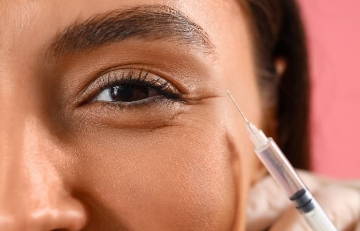 Buy Juvederm Under Eyes Filler Online