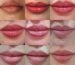 0.5 ML Lip Filler Swelling Stages